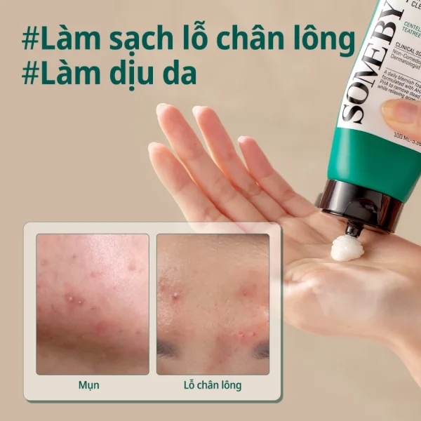 Sữa Rửa Mặt AHA-BHA-PHA 30 Days Miracle Acne Clear Foam Làm Sạch Sâu Cho Da Dầu Mụn nhạy cảm 100ml - Hình ảnh 4